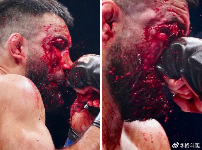 篮球比赛很紧张的歇后语